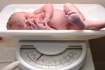 Apgar Score